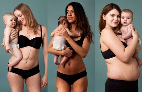 Campanha fotográfica celebra o verdadeiro corpo pós-parto