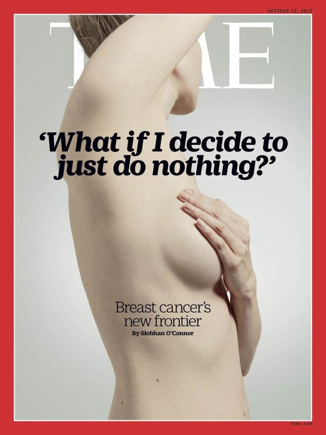 Em outubro de 2015, a revista Time publicou um artigo de fundo onde compilou os testemunhos de várias mulheres diagnosticadas com cancro da mama, mas também de médicos. A decisão de não intervir em estádios iniciais da doença ainda é muito polémica mas, nos Estados Unidos, já vai sendo frequente.