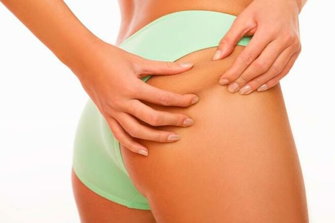 2. Estrias. Outra consequência das toxinas existentes no tabaco é a perda de elasticidade da pele. Ao ficar mais flácida, esta perde a capacidade de se regenerar após alterações de peso, o que aumenta a probabilidade do aparecimento de estrias.