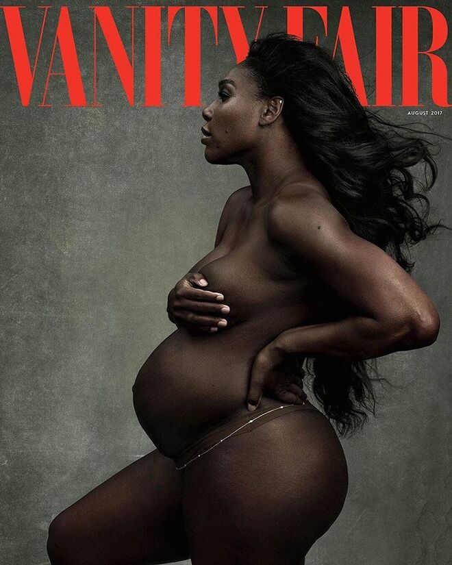 Serena Williams, Vanity Fair (Agosto 2017)