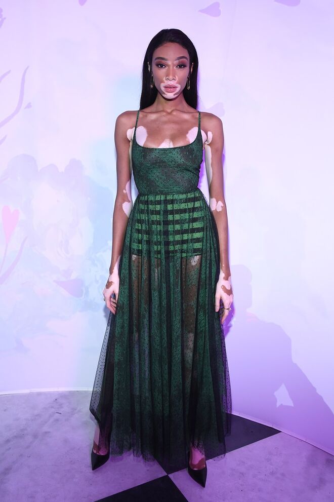 Winnie Harlow
