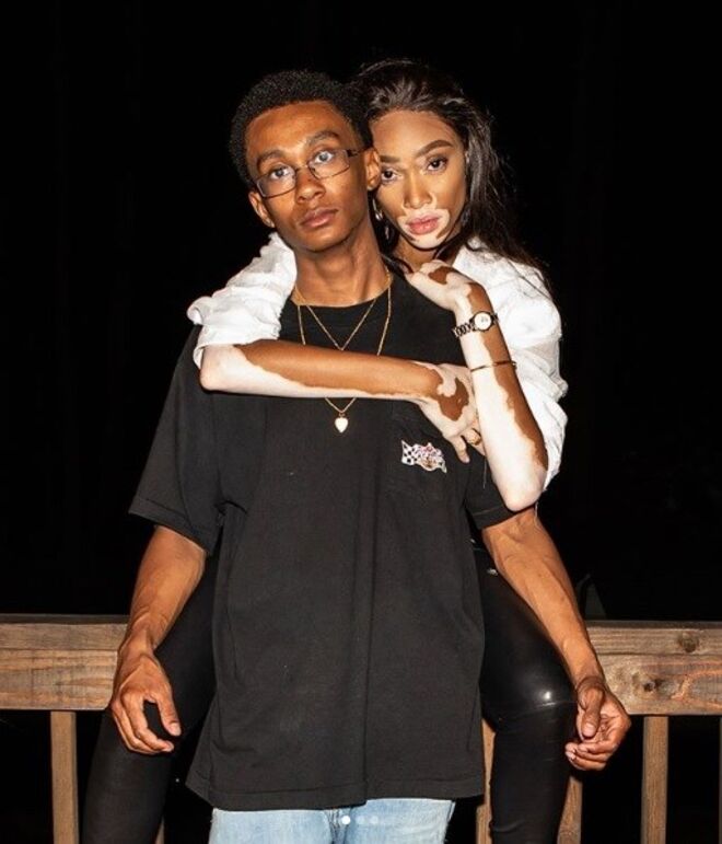 Winnie Harlow com o irmão Jordie