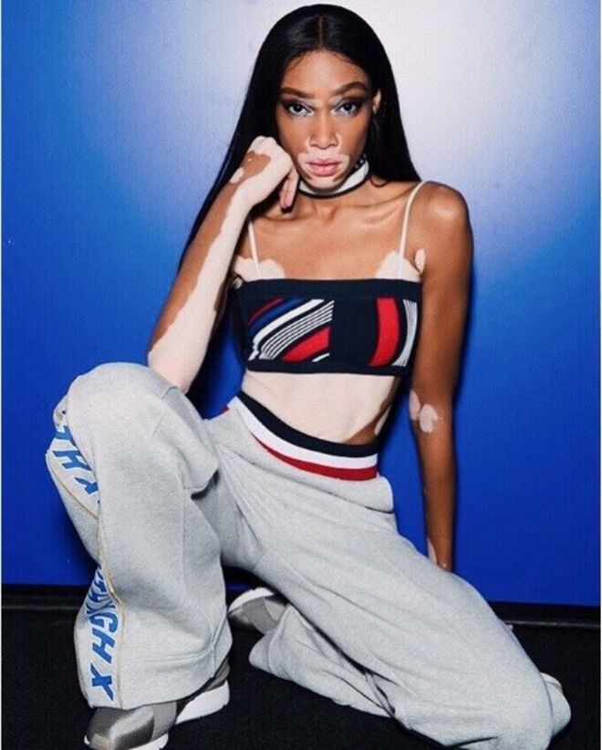 Winnie Harlow para Tommy Hilfiger
