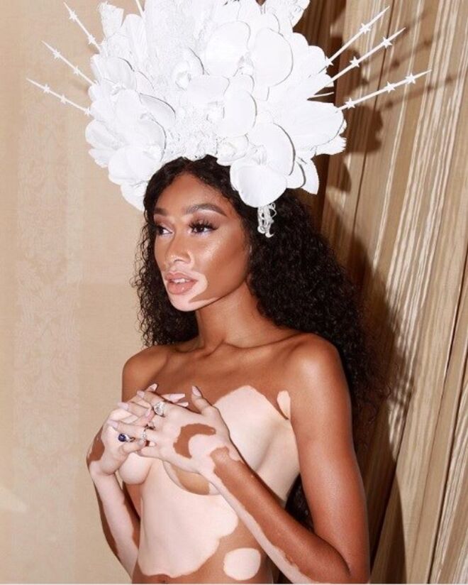 Winnie Harlow
