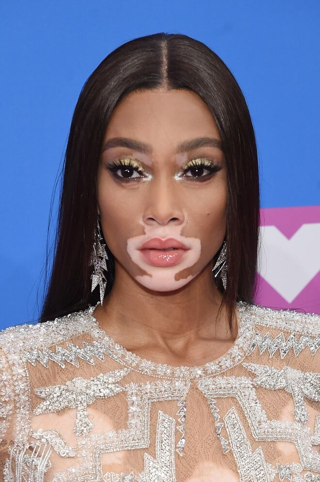Winnie Harlow