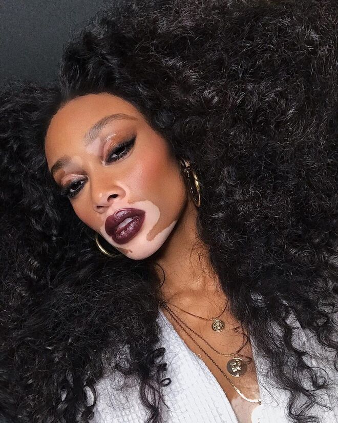 Winnie Harlow