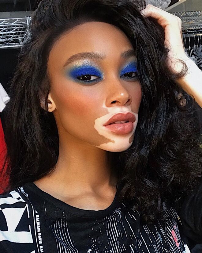 Winnie Harlow