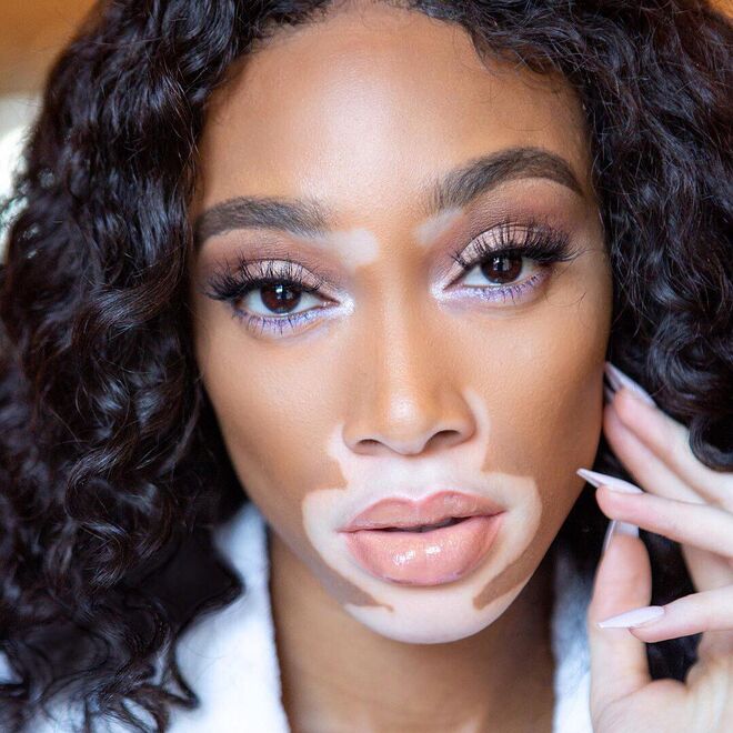 Winnie Harlow