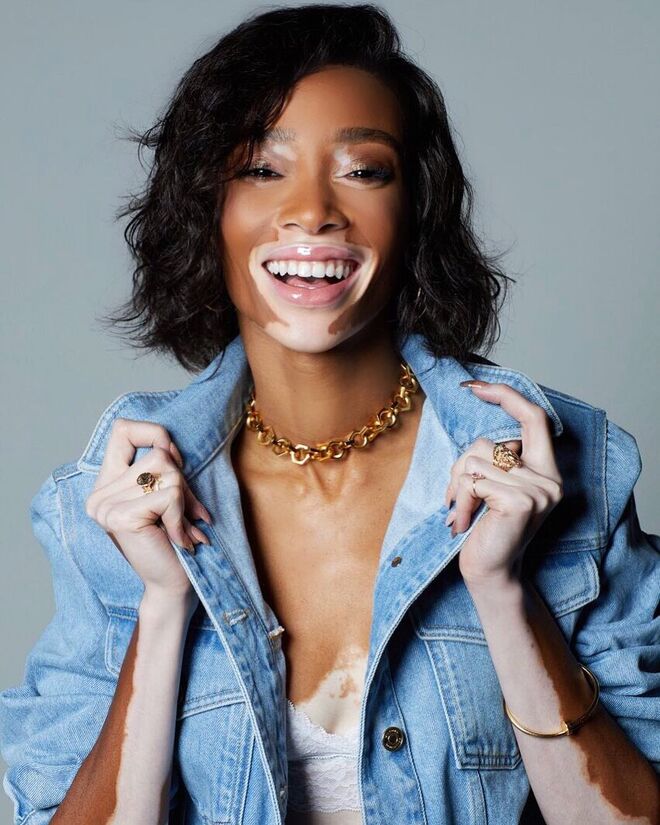 Winnie Harlow