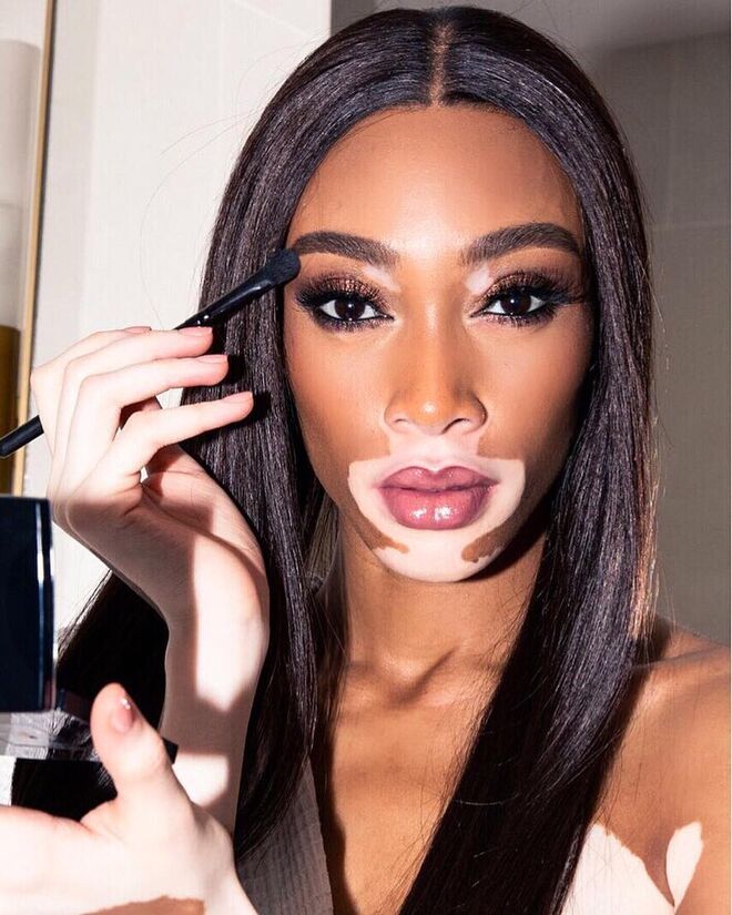 Winnie Harlow