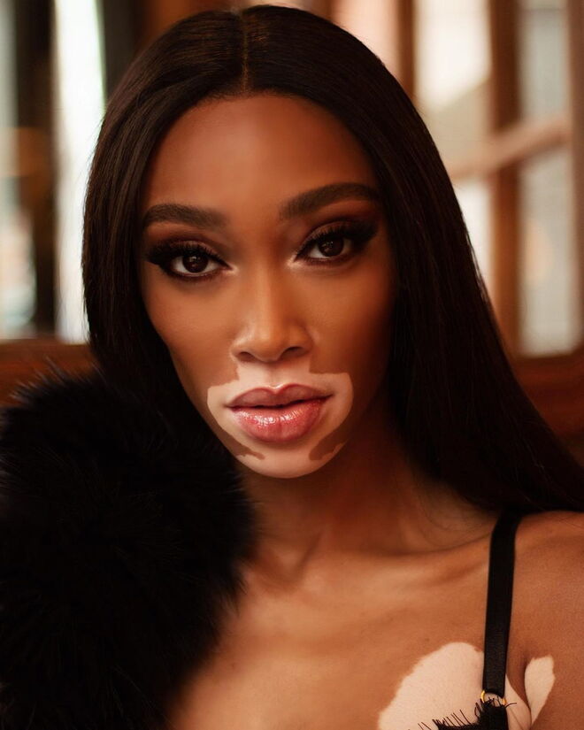 Winnie Harlow