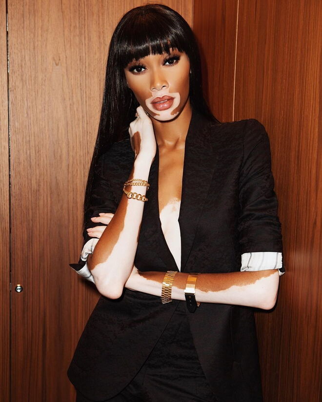 Winnie Harlow
