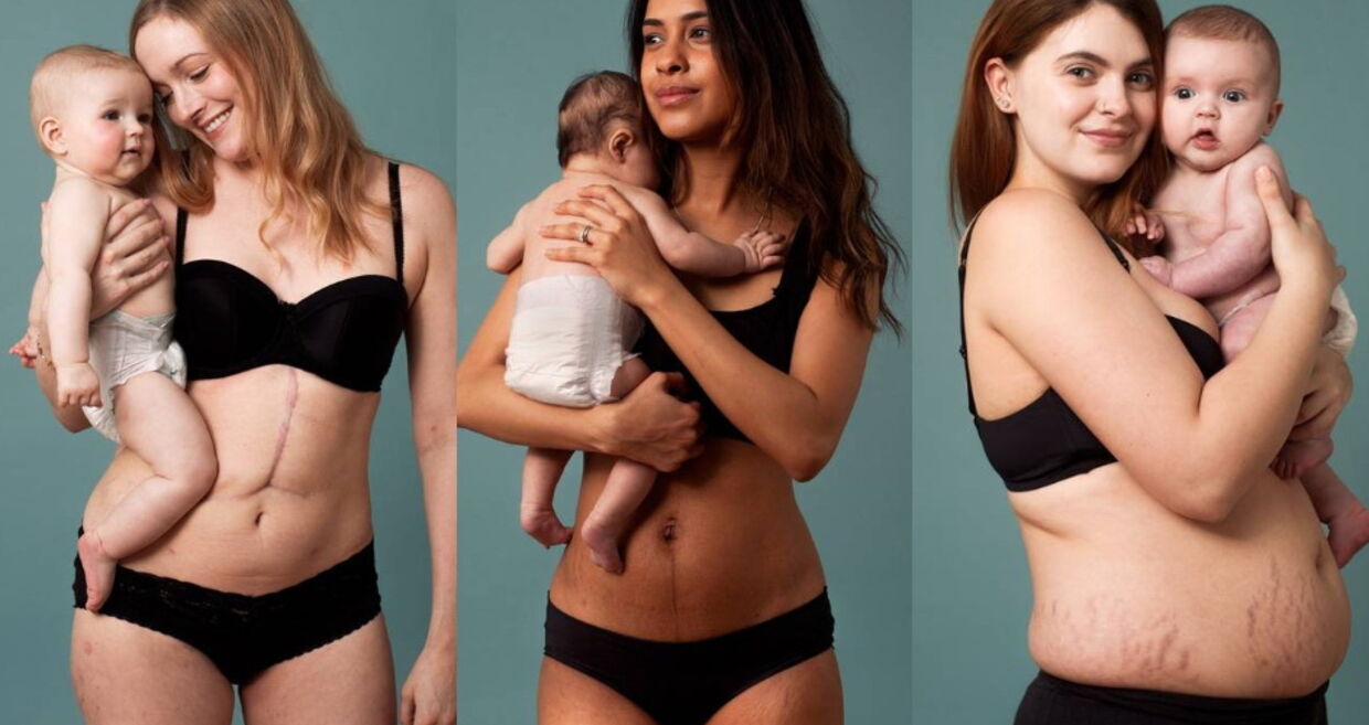 Campanha fotográfica celebra o verdadeiro corpo pós-parto