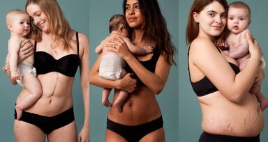 Campanha fotográfica celebra o verdadeiro corpo pós-parto