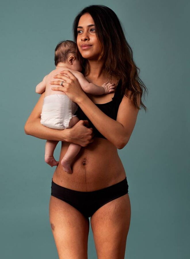 O verdadeiro corpo pós-parto