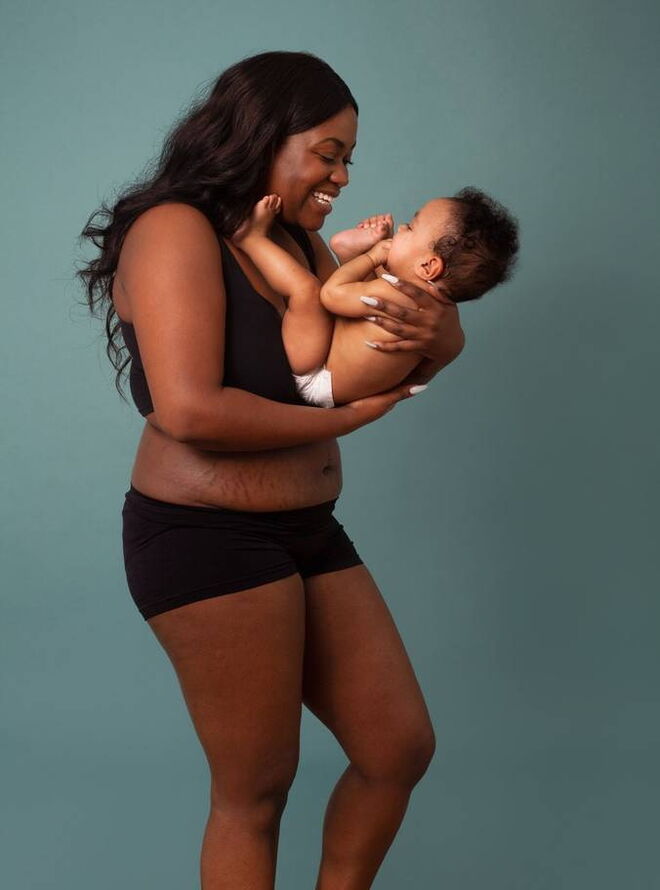 O verdadeiro corpo pós-parto