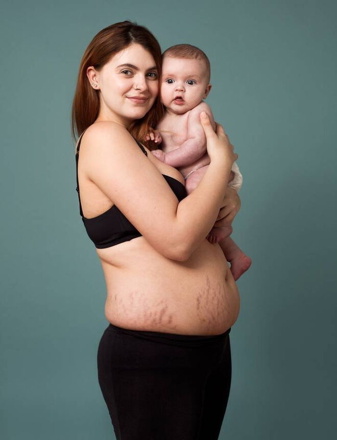 O verdadeiro corpo pós-parto