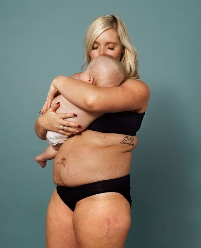 O verdadeiro corpo pós-parto