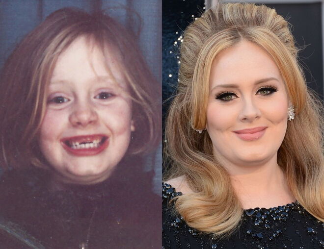 Adele
