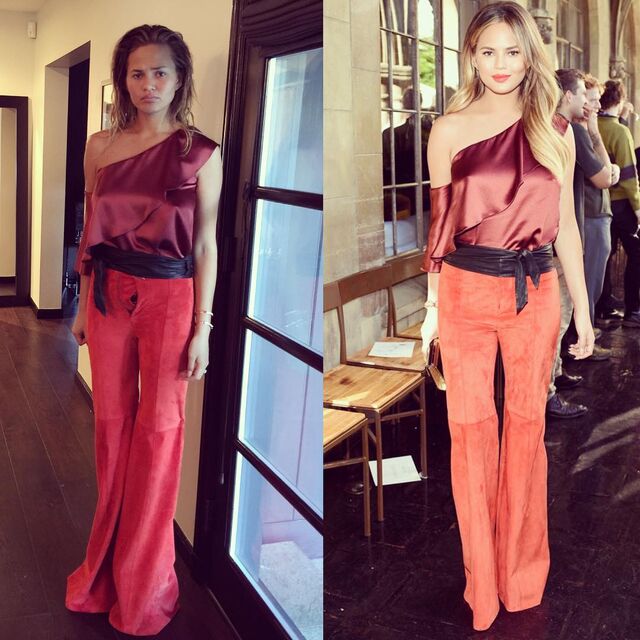 Chrissy Teigen mostrou no instagram o seu precalço