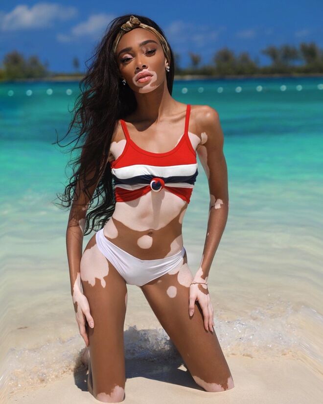 A modelo Winnie Harlow a aproveitar a paradisíacas praias das Bahamas 