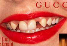 Os dentes imperfeitos são a nova tendência de Beleza