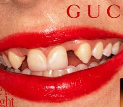 Os dentes imperfeitos são a nova tendência de Beleza