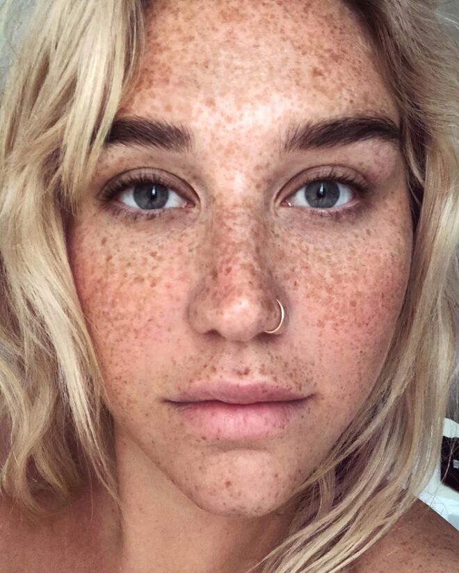 Kesha
