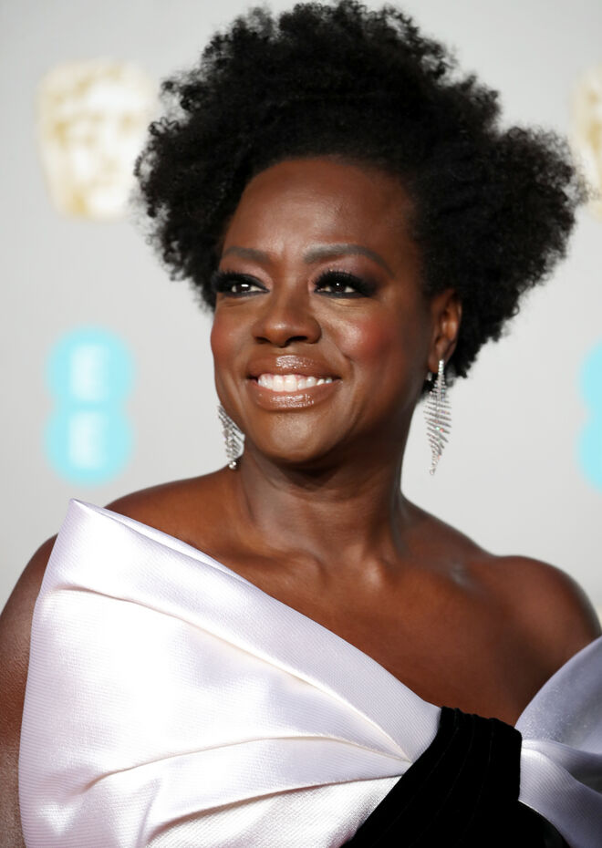 Viola Davis sofreu de alopecia quando tinha 28 anos. Durante muito tempo usou perucas para esconder a falta de cabelo