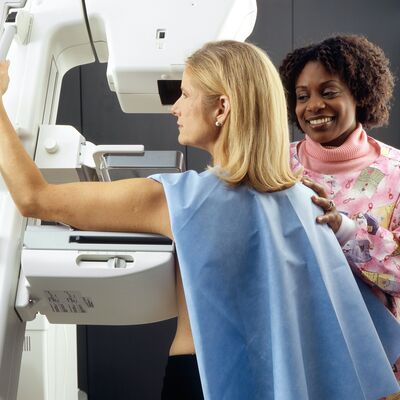 Fatores de risco do cancro da mama: o que podemos e não podemos alterar
