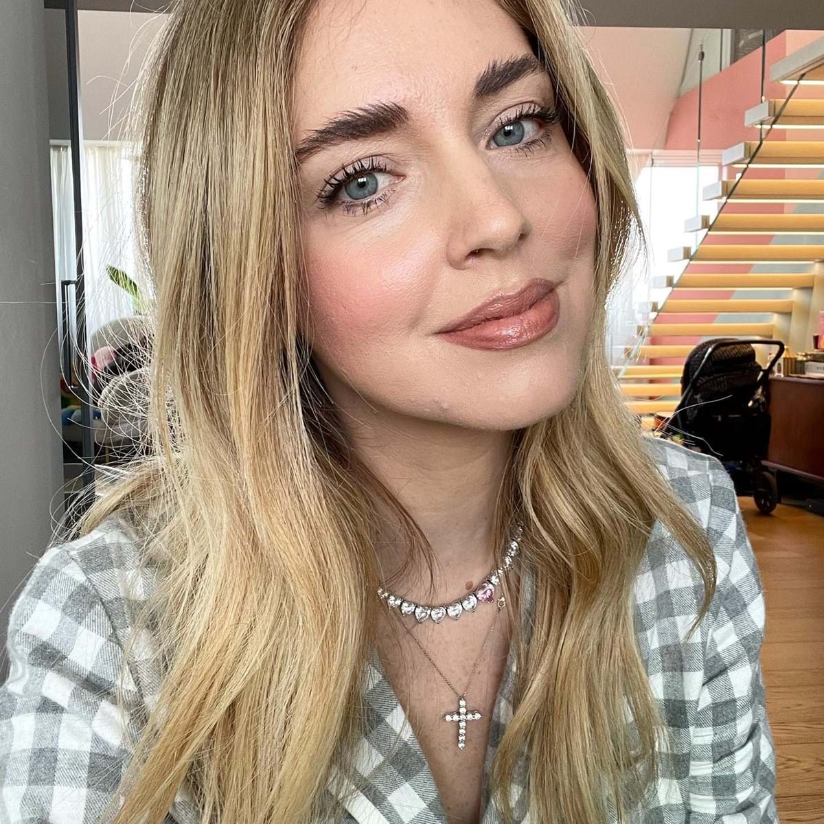 Chiara Ferragni revela luta contra o acne em fotografias inéditas