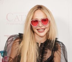 Uma cirurgia estética para alongar as pernas? A controversa operação realizada por uma modelo alemã