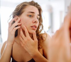 Própolis: o ingrediente secreto para acabar com a oleosidade e as imperfeições da pele