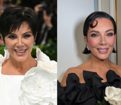 Antes e depois. Estas celebridades ficaram irreconhecíveis depois de supostos facelifts