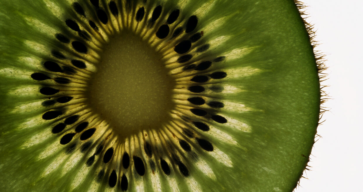 Kiwi: fruta melhora a saúde em 24 horas, mudança simples com grande impacto