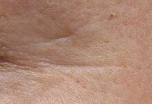 Semana 4 (depois)****