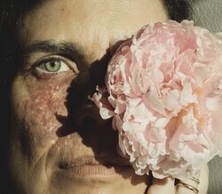 Raquel Luís fala de autoestima e da marca de nascença no rosto