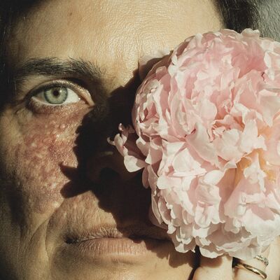 Raquel Luís fala de autoestima e da marca de nascença no rosto