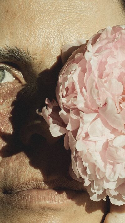 Raquel Luís fala de autoestima e da marca de nascença no rosto