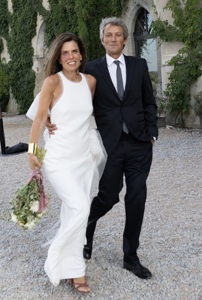 Raquel Luís fala de autoestima e da marca de nascença no rosto