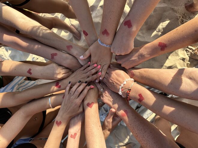 Raquel Luís fala de autoestima e da marca de nascença no rosto