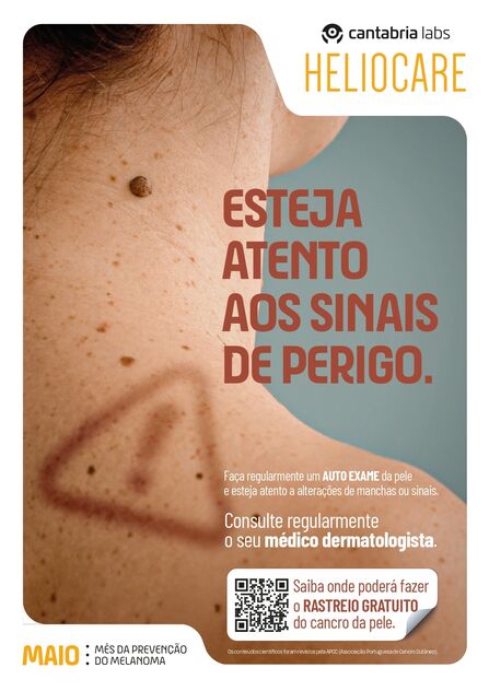 Campanha Euromelanoma alerta para sinais de cancro da pele e a importância do diagnóstico precoce.
